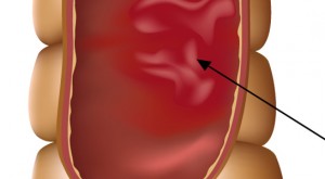 eii-centro-proctologico