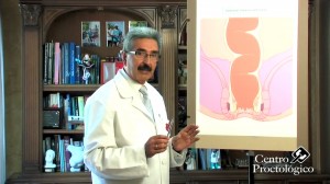 enfermedades-proctologicas-centro-proctologico-dr-german-vazquez