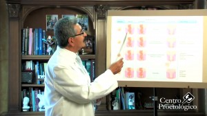 tratamiento-hemorroides-centro-proctologico-dr-vazquez